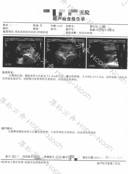 梭形細(xì)胞肉瘤治療