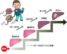 肝炎治療技術(shù),乙型肝炎治療，乙型肝炎治療技術(shù)