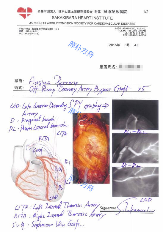 冠心病搭橋手術方案