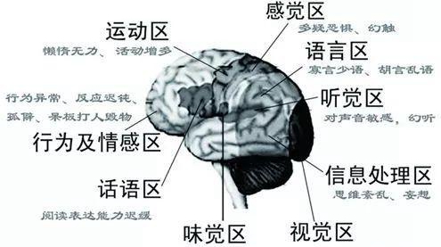 出國(guó)治療肺癌