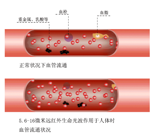 日本預(yù)防心臟病