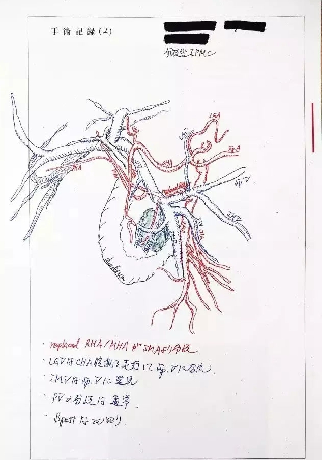 胃癌哪個(gè)國(guó)家治療好