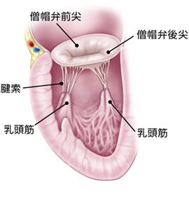 心臟瓣膜病