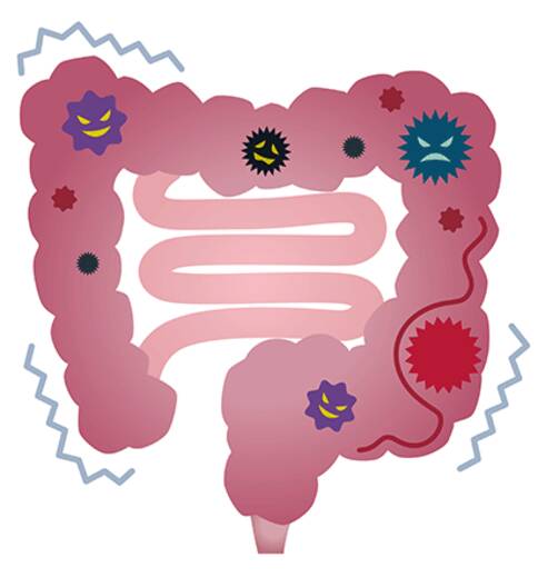 美國(guó)看病,美國(guó)腸癌