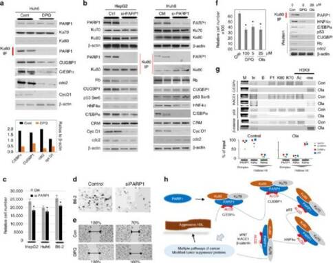 出國(guó)看病,兒童肝癌治療