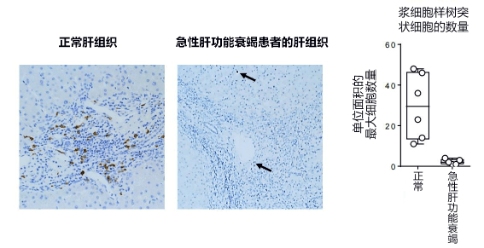日本發(fā)現(xiàn)控制急性肝衰竭的新型免疫細胞，有望開發(fā)新治療方法