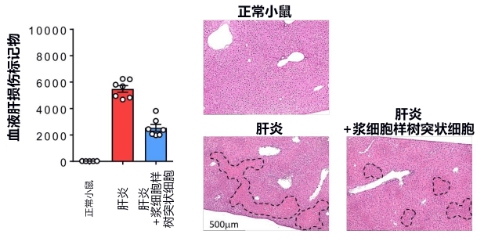 日本發(fā)現(xiàn)控制急性肝衰竭的新型免疫細胞，有望開發(fā)新治療方法