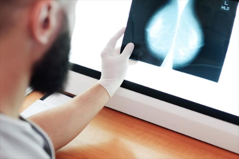 DNA甲基化是否會影響阿司匹林在乳腺癌患者機體中的效應