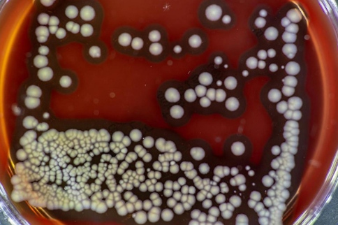 銅綠單假細(xì)菌容易在囊性纖維化肺中大量繁殖