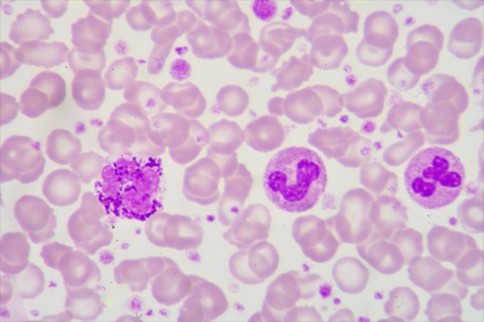 研究人員發(fā)現(xiàn)分子內(nèi)部的兩個元素對于其作為腫瘤抑制因子的功能比其他元素更重要