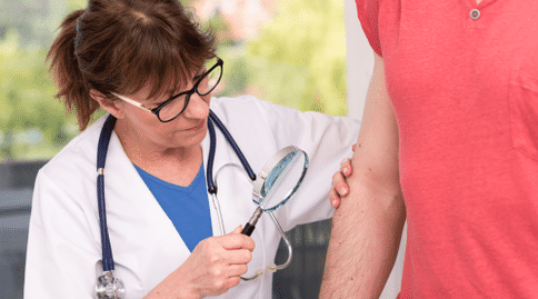 出國看?。褐匕酰⌒滦兔庖咧委煼椒ǚ椒ǚ椒ㄒ褢?zhàn)勝惡性黑色素瘤