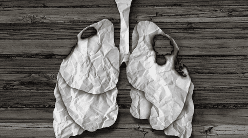 肺癌出國治療：英國新檢測手段可以早期發(fā)現(xiàn)肺癌