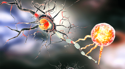 腫瘤出國(guó)治療：新技能可區(qū)分原發(fā)性頭頸部腫瘤和肺部轉(zhuǎn)移瘤