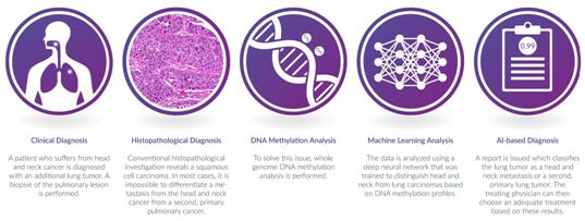 腫瘤出國(guó)治療：新技能可區(qū)分原發(fā)性頭頸部腫瘤和肺部轉(zhuǎn)移瘤