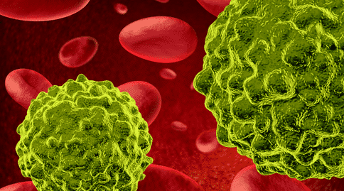 癌癥出國(guó)治療：癌癥轉(zhuǎn)移新發(fā)現(xiàn)-癌細(xì)胞轉(zhuǎn)移十分“懶散”