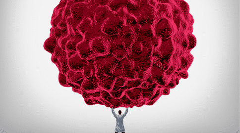 癌癥出國治療：英國研究人員發(fā)現(xiàn)提高抗癌效果的新方法！