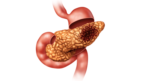 研究發(fā)現線粒體自噬或可促進胰腺癌發(fā)展，組織癌細胞繁殖指日可待！