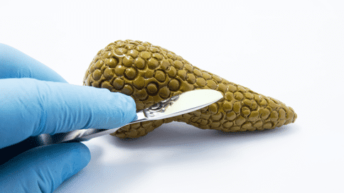 研究發(fā)現線粒體自噬或可促進胰腺癌發(fā)展，組織癌細胞繁殖指日可待！