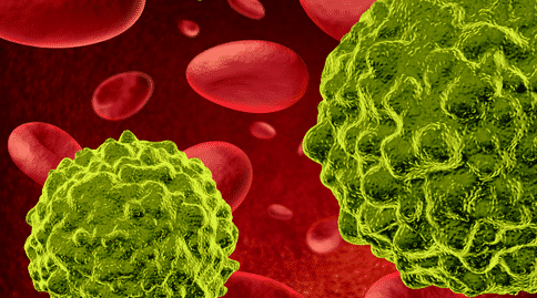 癌癥出國治療：癌癥耐受性問題該如何解決？新研究提供方向