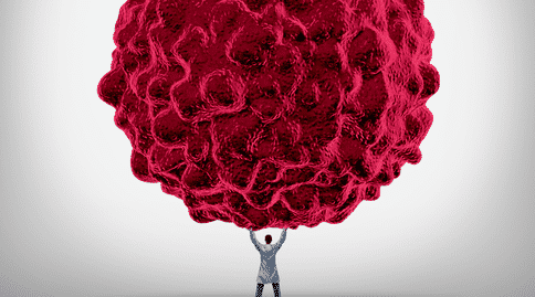 癌癥出國治療：突破常規(guī)！研究人員發(fā)現(xiàn)機體老化或可阻礙癌癥進展