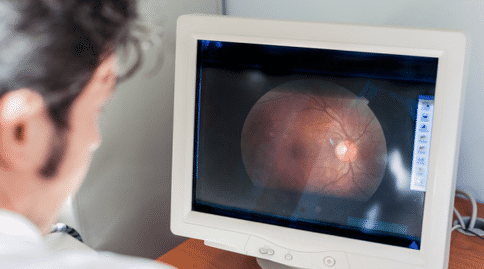 出國(guó)看病:新研究指出人工智能篩查糖尿病性視網(wǎng)膜病變的概率高達(dá)90%