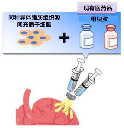 日本開發(fā)出一種治療心力衰竭的新技能，目前已進行臨床試驗！