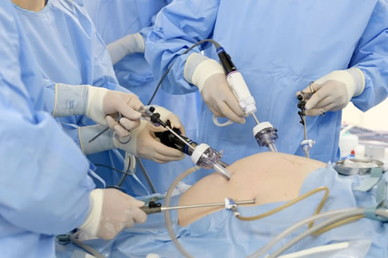 日本手術(shù)治療癌癥