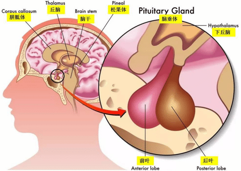 腦垂體瘤分類(lèi)