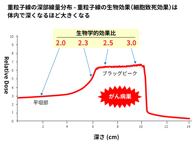 重離子治療