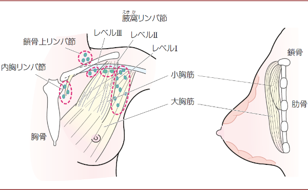 日本乳腺癌治療