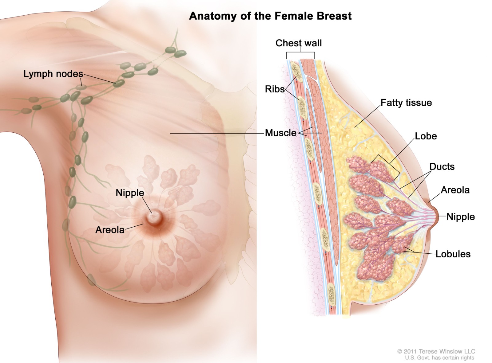 三陰乳腺癌治療