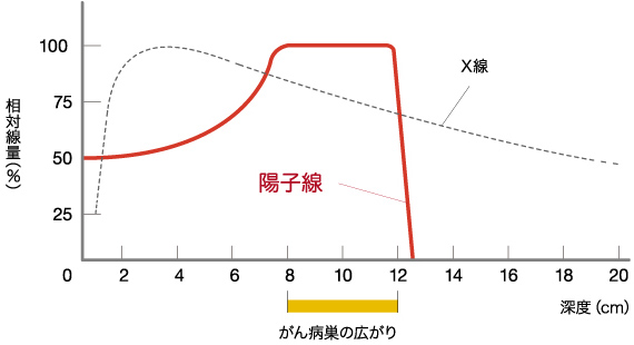 日本質(zhì)子重離子放射治療