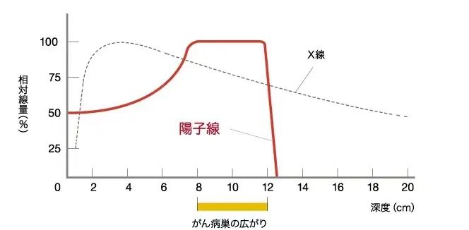 垂體瘤質(zhì)子治療