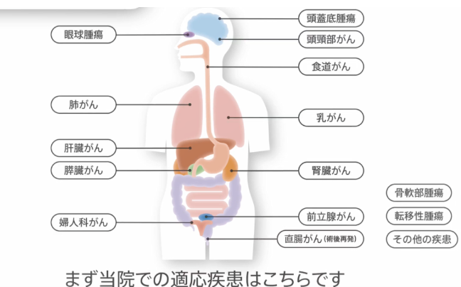 日本質(zhì)子重離子治療